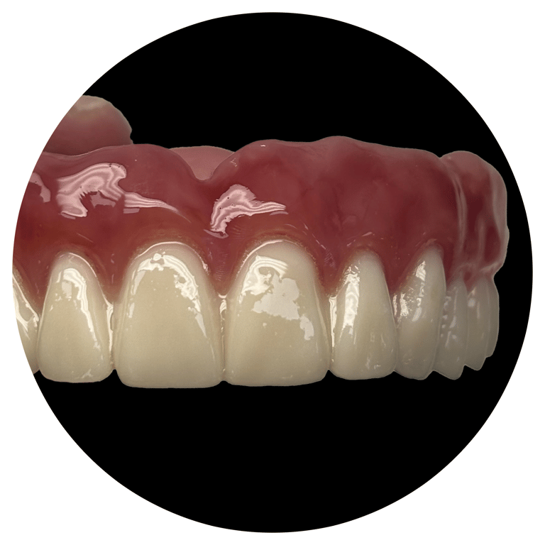 Dentures